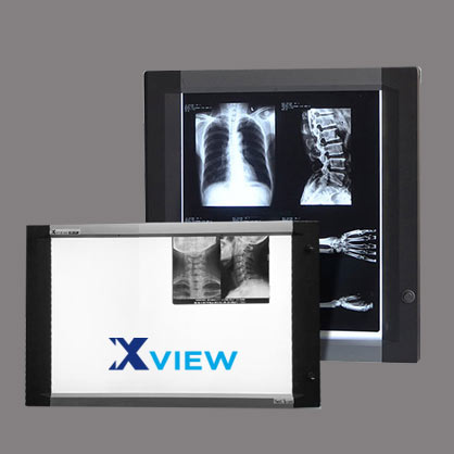 X-Ray View Box